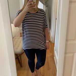 Stripe Tunic 💙🤍